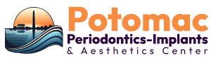 Potomac Periodontics Implant