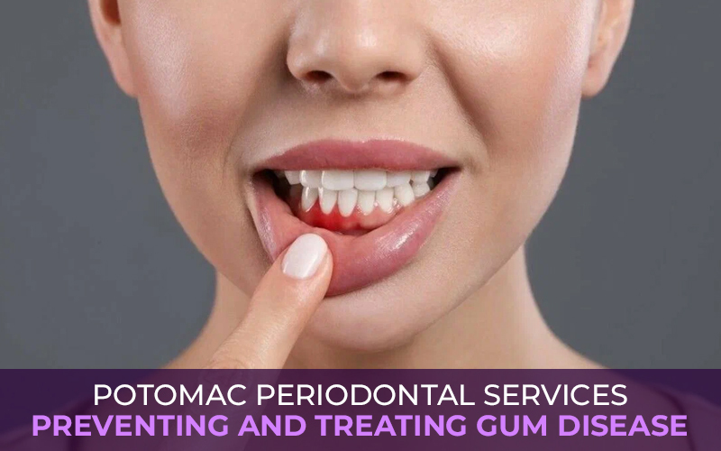 Potomac Periodontal Services: Preventing and Treating Gum Disease