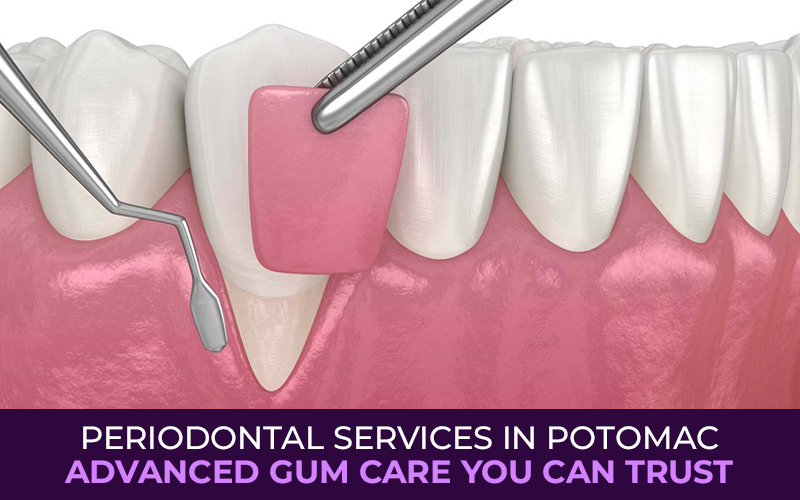 Periodontal Services in Potomac: Advanced Gum Care You Can Trust