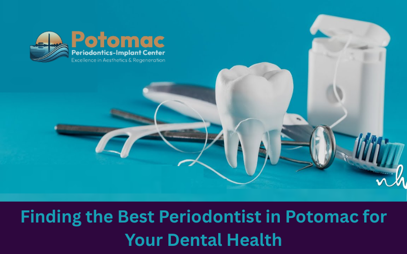 Finding the Best Periodontist in Potomac for Your Dental Health