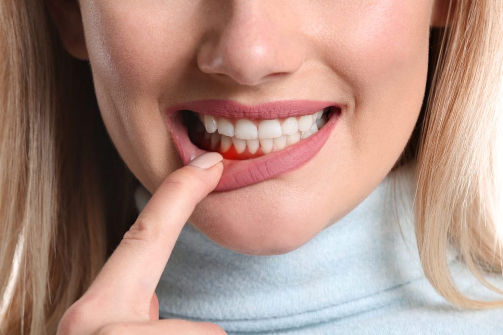Trusted Periodontist in Bethesda, MD: Advanced Gum Care & Treatment
