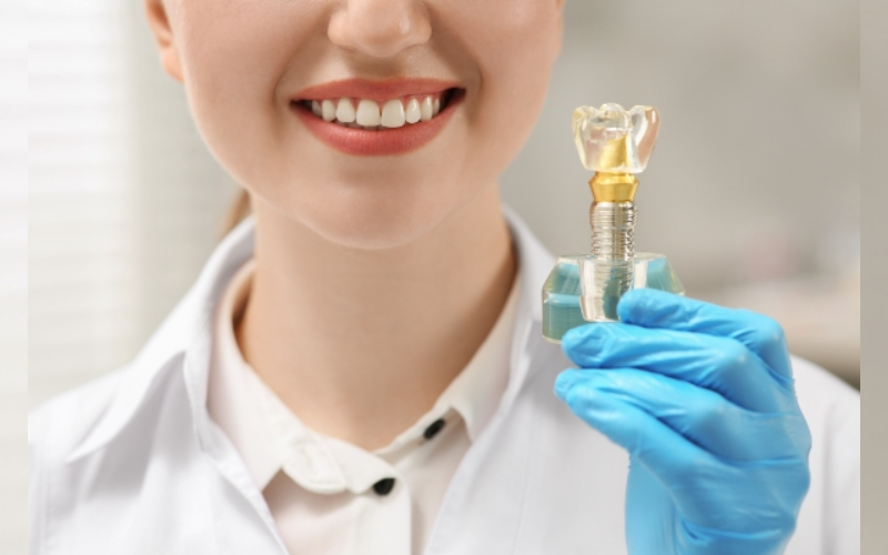 Affordable Dental Implants in Potomac: Restore Your Confidence