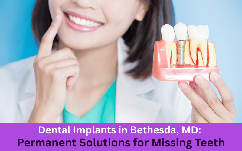 Dental Implants in Bethesda, MD: Permanent Solutions for Missing Teeth