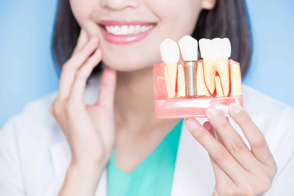 Dental Implants in Potomac: Restore Your Smile with Confidence