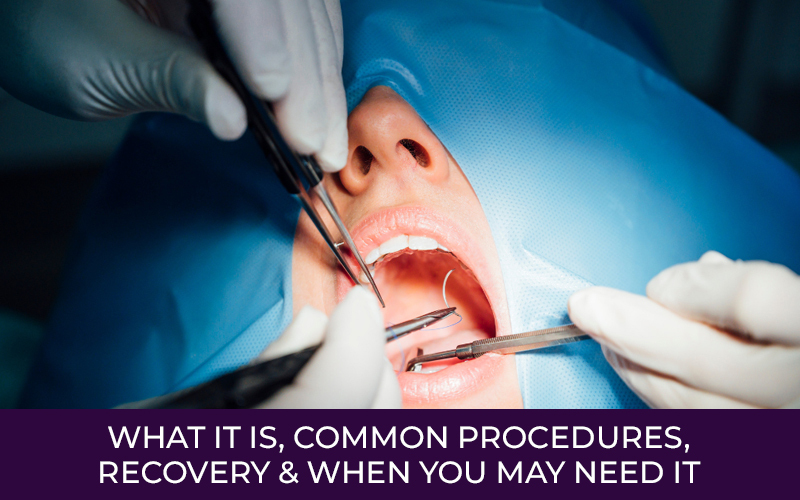 Oral Surgery: What It Is, Common Procedures, Recovery & When You May Need It